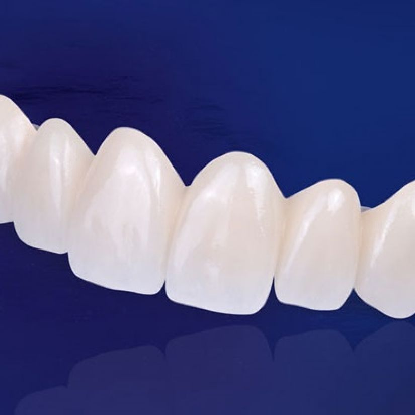 Răng Toàn Sứ Ceramill (Đức)