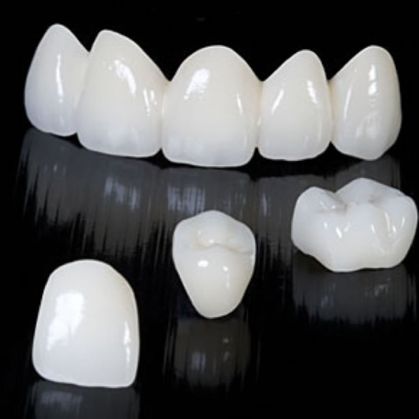 Răng sứ Emax